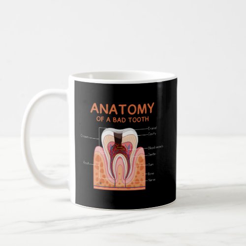 Anatomy Of A Bad Tooth Dental Humor For Orthodonti Coffee Mug