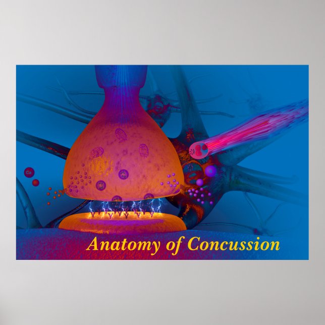 Anatomy of Concussion Poster (Front)