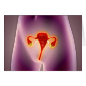 Anatomy Of Female Body With Uterus (Front Horizontal)