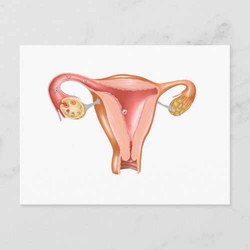 Anatomy Of Female Uterus 1 Postcard