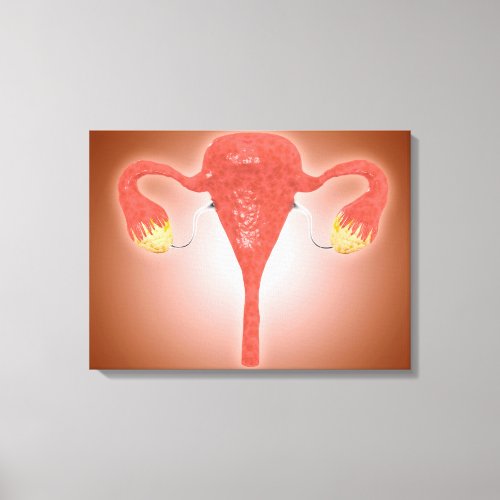 Anatomy Of Female Uterus With Ovaries Canvas Print