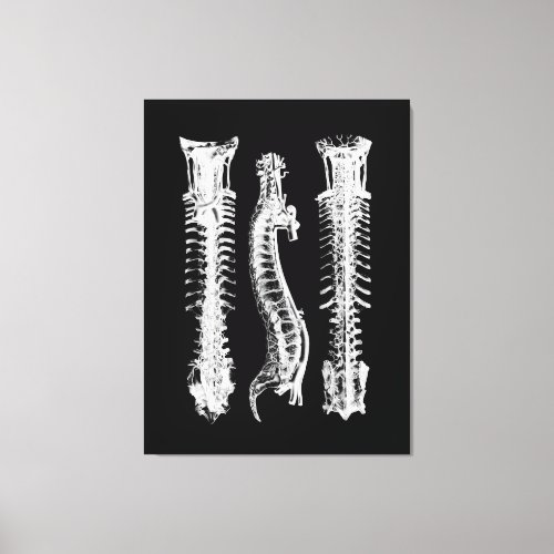 Anatomy of Human Spine Large Canvas Art