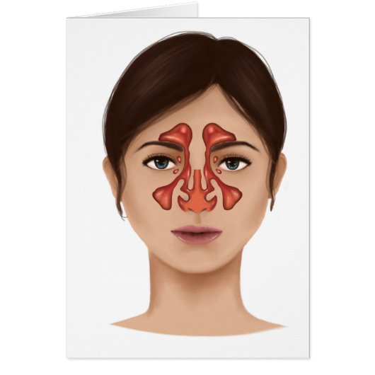 Anatomy Of Nasal Sinuses Cards (Front)