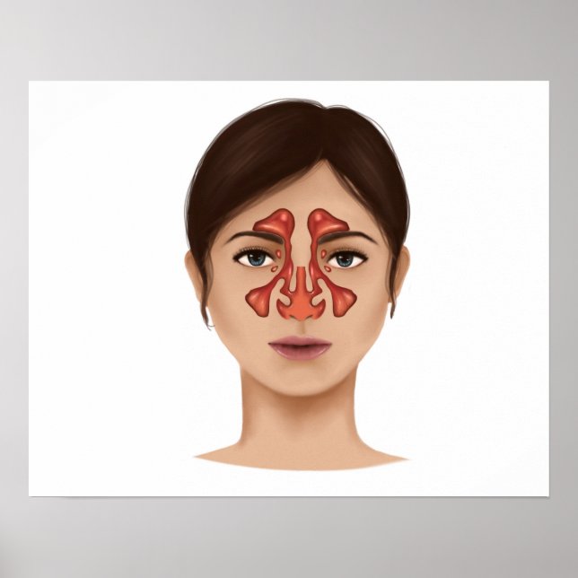 Anatomy Of Nasal Sinuses Poster (Front)