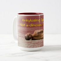 Ankylosing Spondylitis, not a dinosaur mug