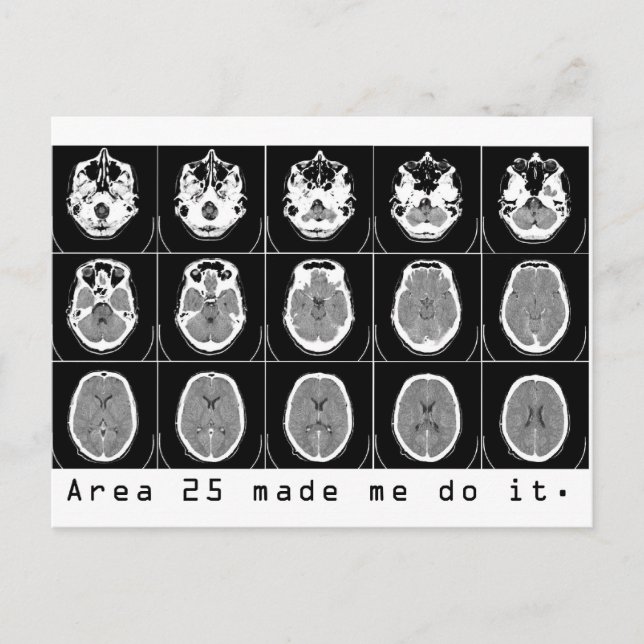 Area 25 made me do it. postcard (Front)
