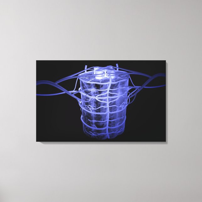 Arteries surrounding part of the spinal column canvas print (Front)