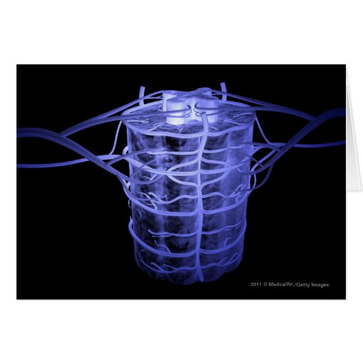 Arteries surrounding part of the spinal column cards (Front Horizontal)