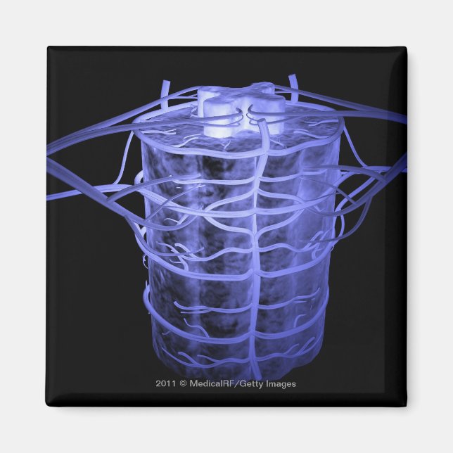 Arteries surrounding part of the spinal column magnet (Front)