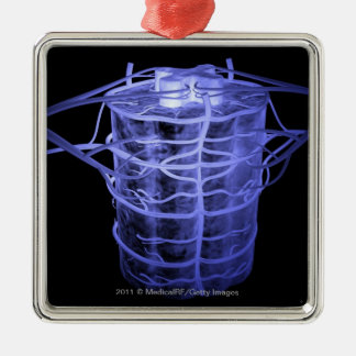 Arteries surrounding part of the spinal column metal ornament