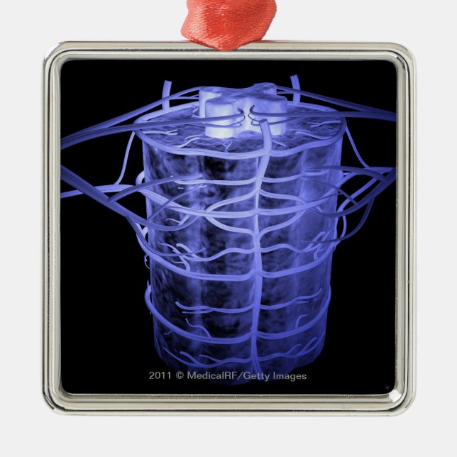Arteries surrounding part of the spinal column metal ornament (Front)