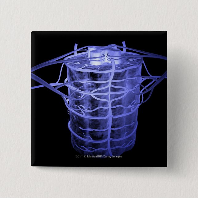 Arteries surrounding part of the spinal column pinback button (Front)