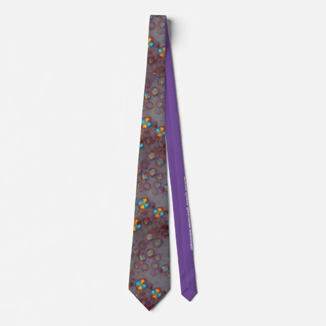 Asteroid hyalosis (polarization microscopy) neck tie (Front)