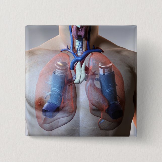 Asthma Button (Front)