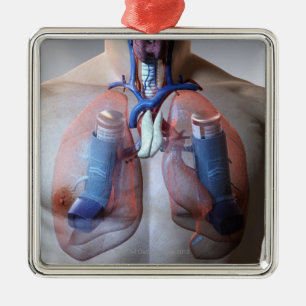 Asthma Metal Ornament