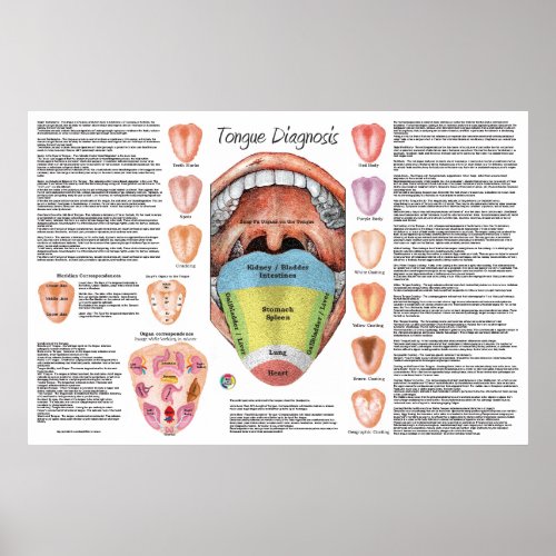 Ayurvedic Tongue Diagnosis Map  Poster