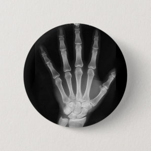 B&W X-ray Skeleton Hand Button