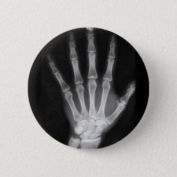 B&w X-ray Skeleton Hand Button by VoXeeD at Zazzle