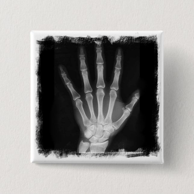 B&W X-ray Skeleton Hand Button (Front)