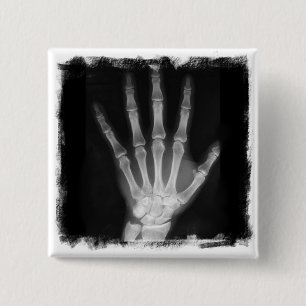 B&W X-ray Skeleton Hand Button