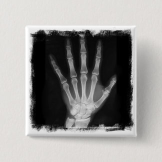 B&W X-ray Skeleton Hand Button