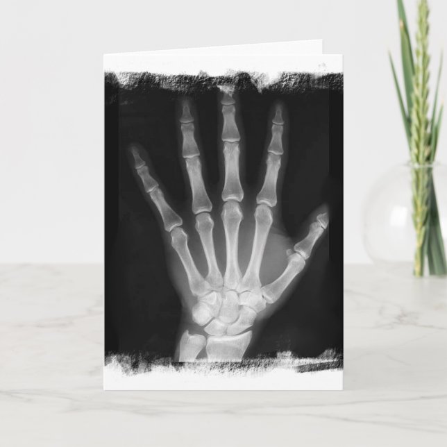 B&W X-ray Skeleton Hand Card (Front)