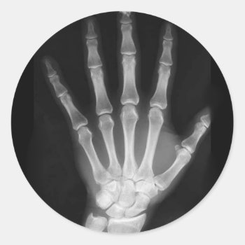 B&w X-ray Skeleton Hand Classic Round Sticker by VoXeeD at Zazzle
