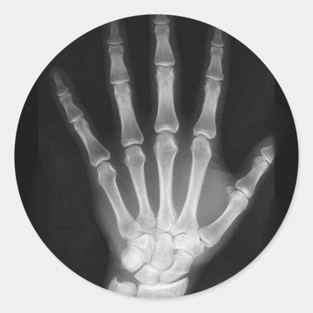 B&W X-ray Skeleton Hand Classic Round Sticker (Front)