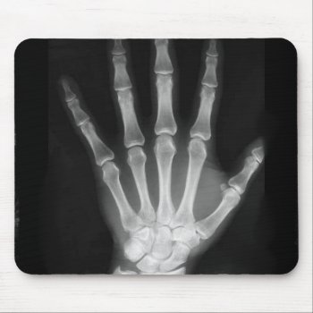B&w X-ray Skeleton Hand Mouse Pad by VoXeeD at Zazzle