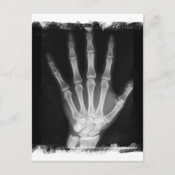 B&w X-ray Skeleton Hand Postcard by VoXeeD at Zazzle