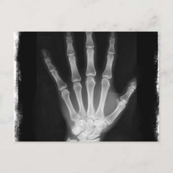 B&w X-ray Skeleton Hand Postcard by VoXeeD at Zazzle