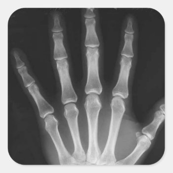 B&w X-ray Skeleton Hand Square Sticker by VoXeeD at Zazzle