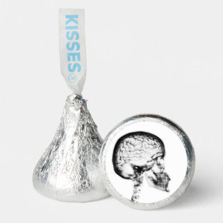 B&W X-Ray Skull Brain Hershey®'s Kisses®