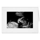 Baby (Front Horizontal)