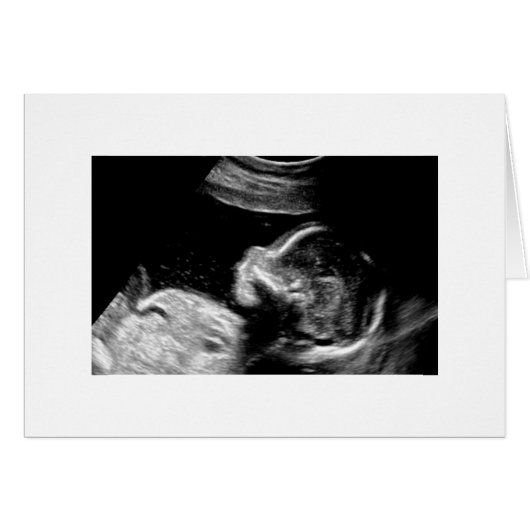 Baby Cards (Front Horizontal)