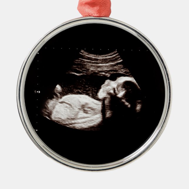 Baby Christmas Pregnancy Ultrasound Photo Classy Metal Ornament (Front)