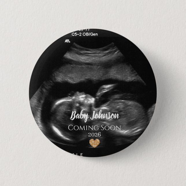Baby Coming Soon Ultrasound Gold heart  Button (Front)