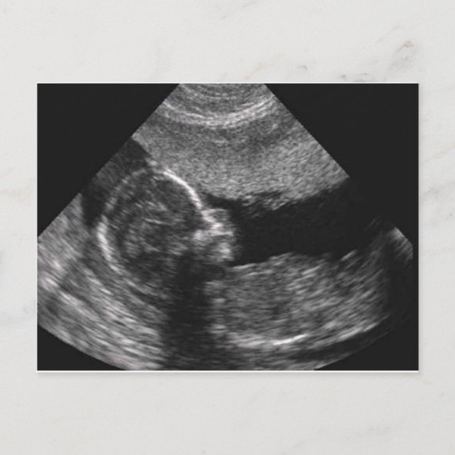 baby face,card postcard (Front)