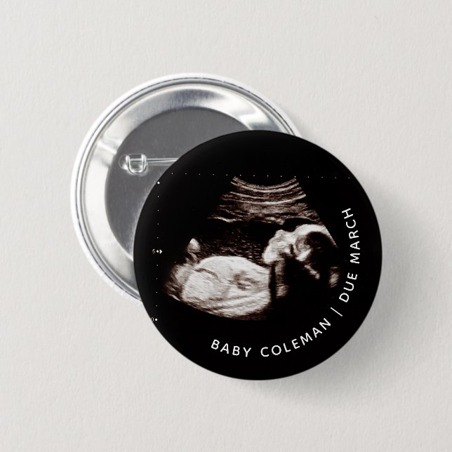 Baby photo ultrasound announcement coming soon button (Front & Back)