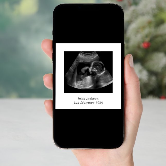 Baby Scan Photo Announcement Card (Front Digital)