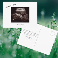  Baby Shower Ultrasound Cute Font Thank You
