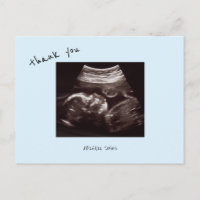 Baby Shower Ultrasound Cute Icy Blue Thank You