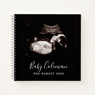 Baby Sonogram Personalized Memory Pregnancy Book