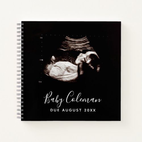Baby Sonogram Personalized Memory Pregnancy Book