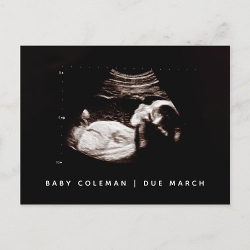 Baby Sonogram Pregnancy Arrival Announcement Photo Postcard