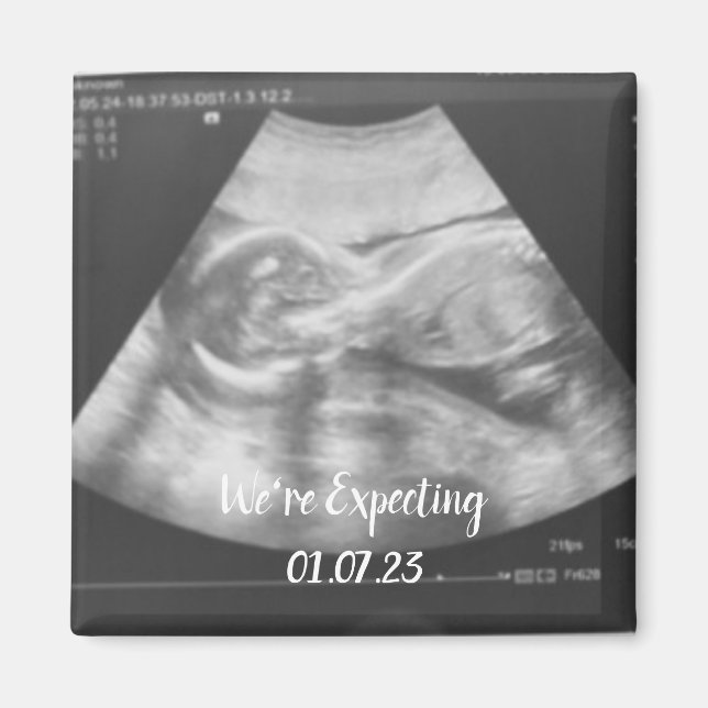 baby ultrasound announcement  magnet (Front)