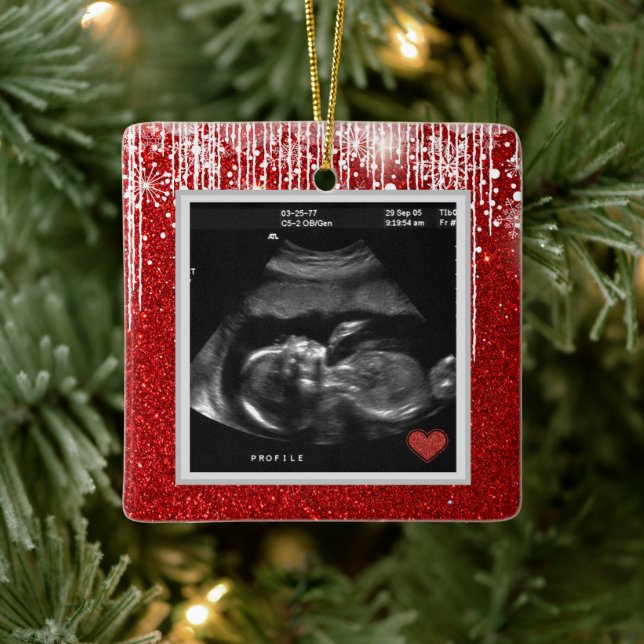 Baby Ultrasound Coming Soon Photo  Ceramic Ornament (Tree)
