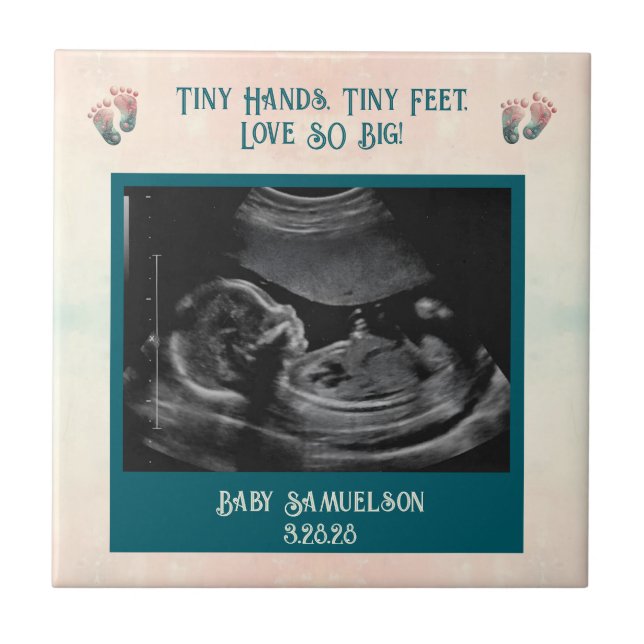 Baby Ultrasound Keepsake Gift Box Ceramic Tile (Front)