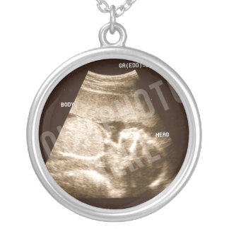 Baby Ultrasound Keychain Silver Plated Necklace