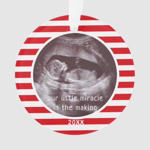 Baby Ultrasound Photo Red White Stripe Christmas Ornament